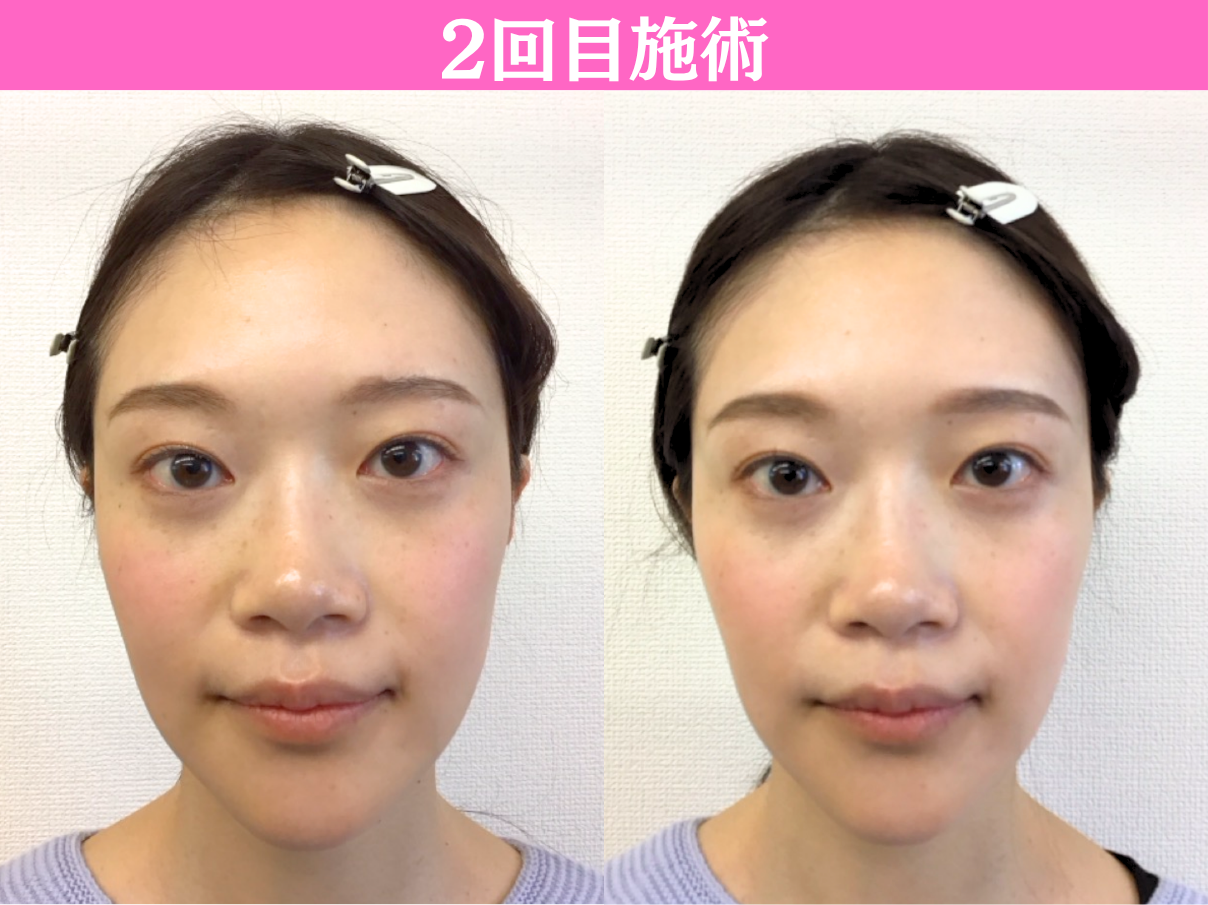 2回目